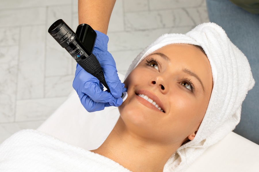 A Procell microchanneling treatment in progress